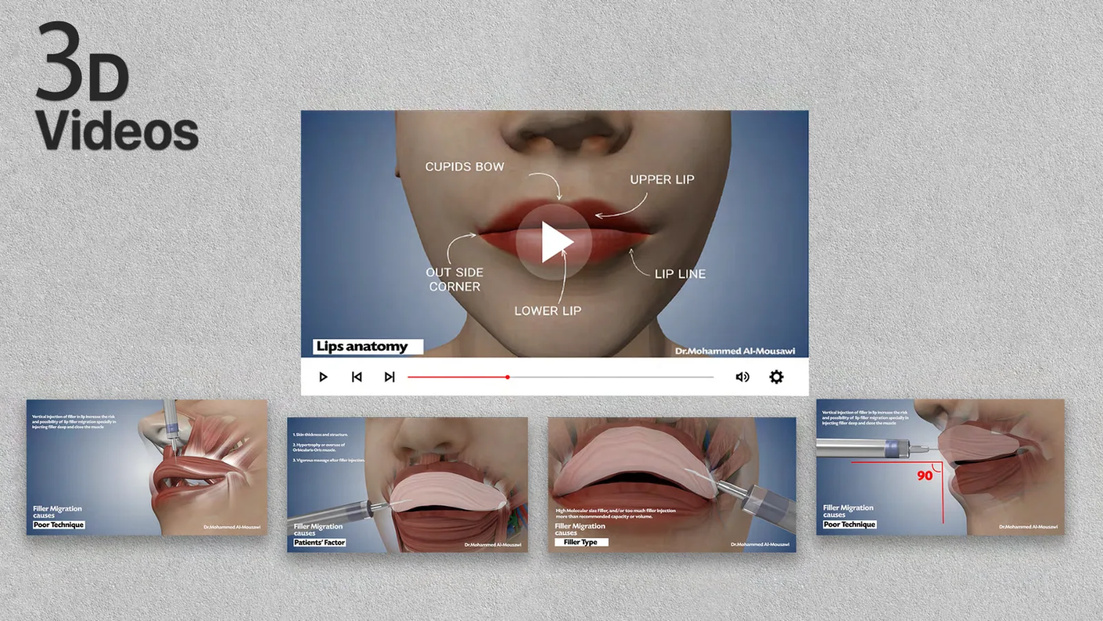 3D Videos — Medical 3D