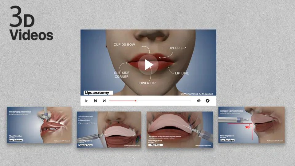 3D Videos — Medical 3D